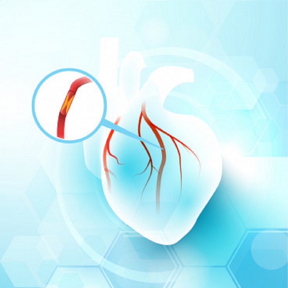Cardiology
